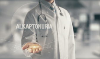 Alkaptonuria – leczenie dietetyczne alkaptonuria