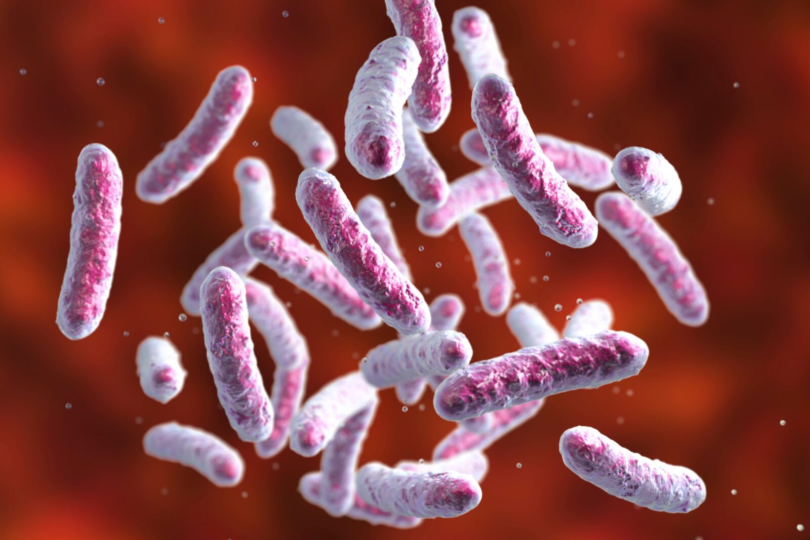 shigella