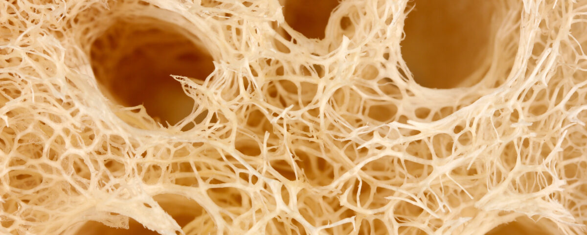 osteoporoza