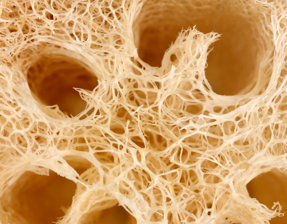 osteoporoza